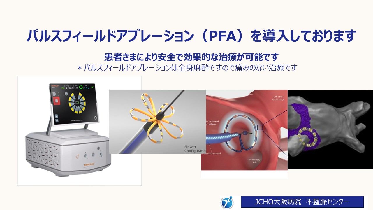 パルスフィールドアブレーション（PFA）を導入しております