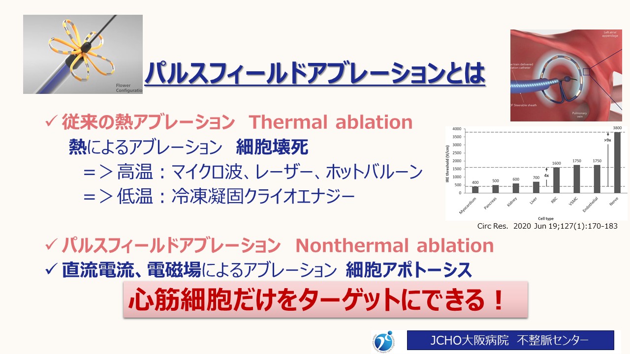 パルスフィールドアブレーションとは