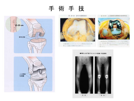 手術手技