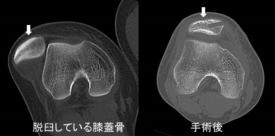手術治療