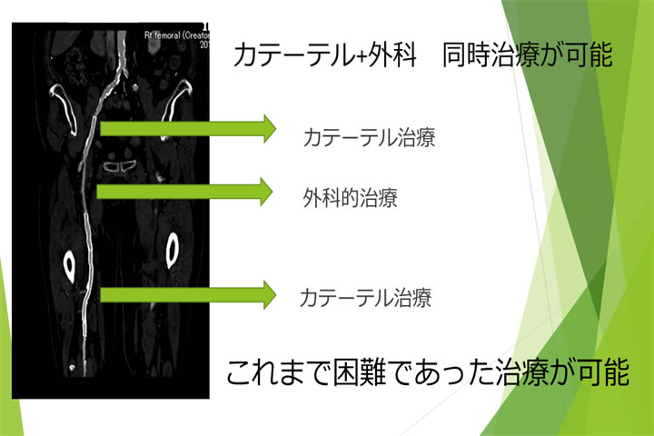 ここが違う！JCHO 大阪病院