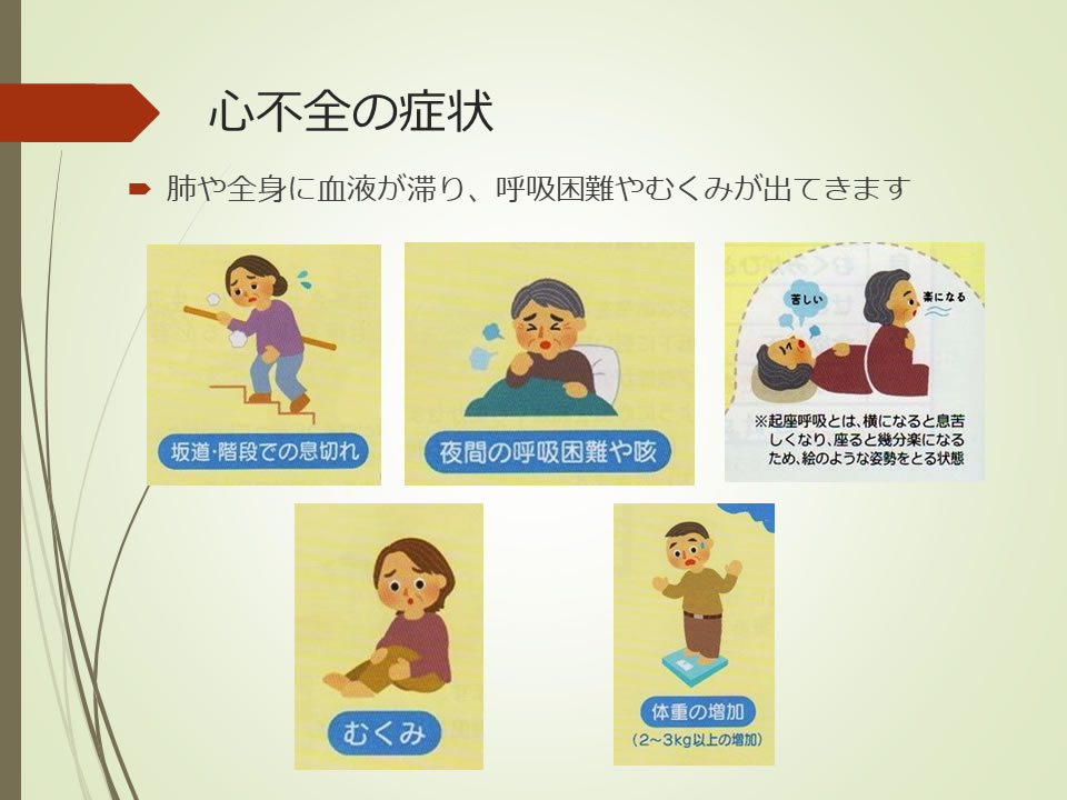 心不全の症状