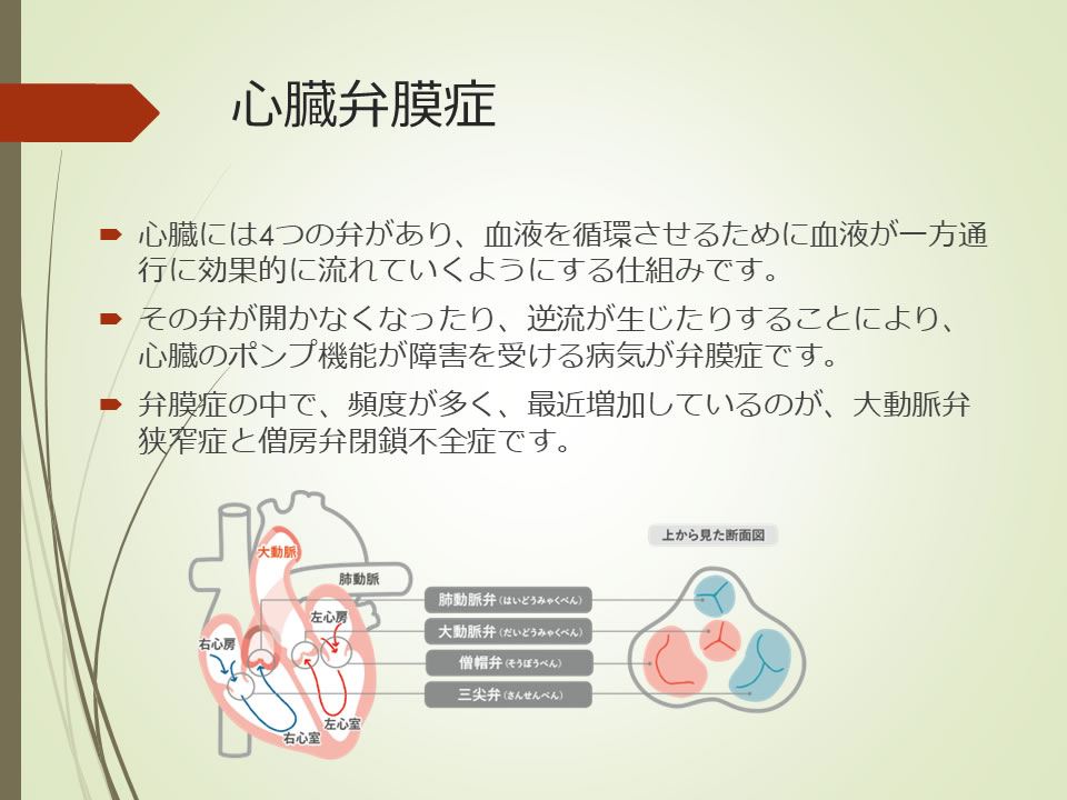 心臓弁膜症