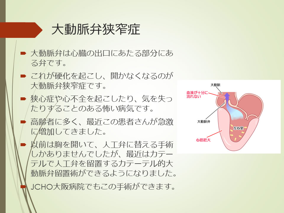 心臓弁膜症