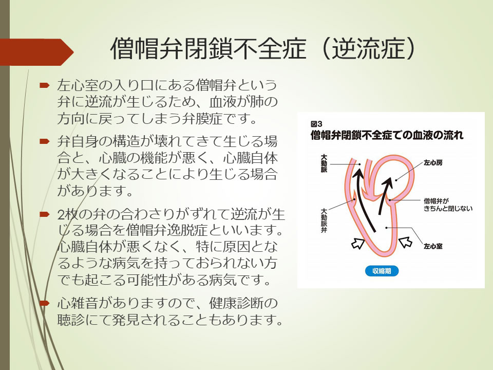 心臓弁膜症