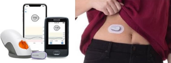 Dexcom　G6