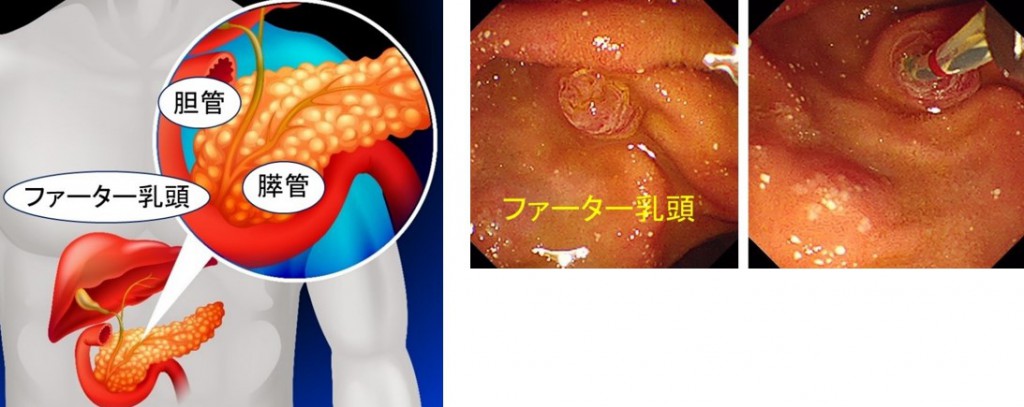 胆管や膵管は十二指腸のファーター乳頭