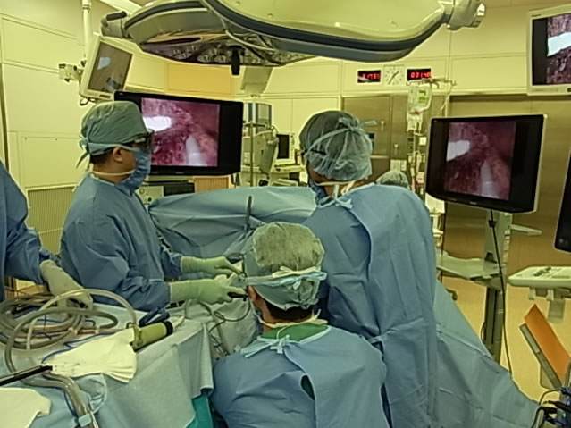 腹腔鏡下肝切除術の手術風景