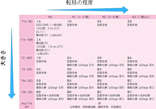 胃癌の進行度 ステージ分類