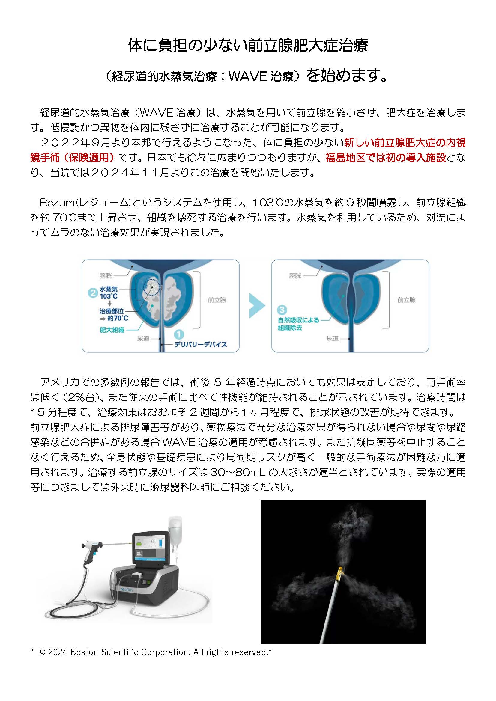 体に負担の少ない前立腺肥大症治療