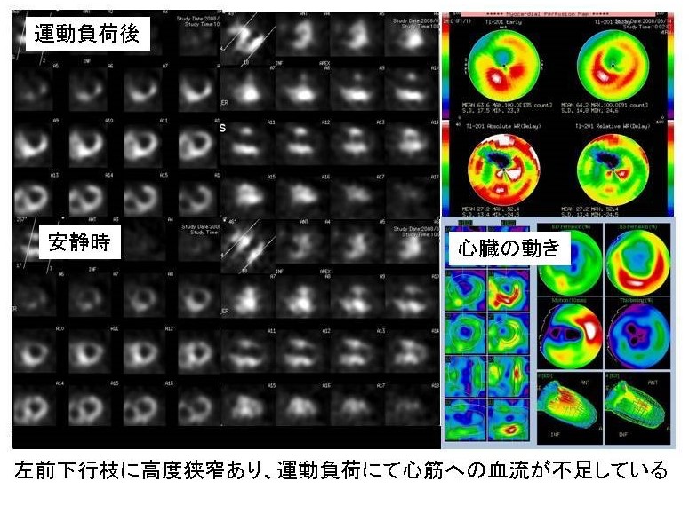 junkan_shinkinshinchi03-2