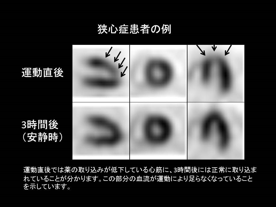 junkan_shinkinshinchi04