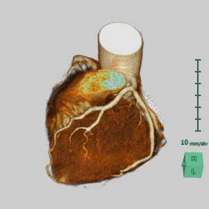 3D_Heart_CT_Check