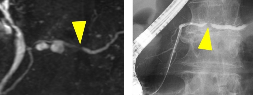 どの手順が適切ですか?