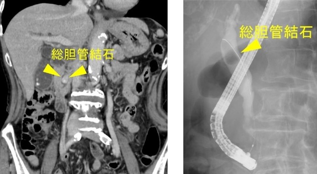 手続きの準備はどのように異なりますか?